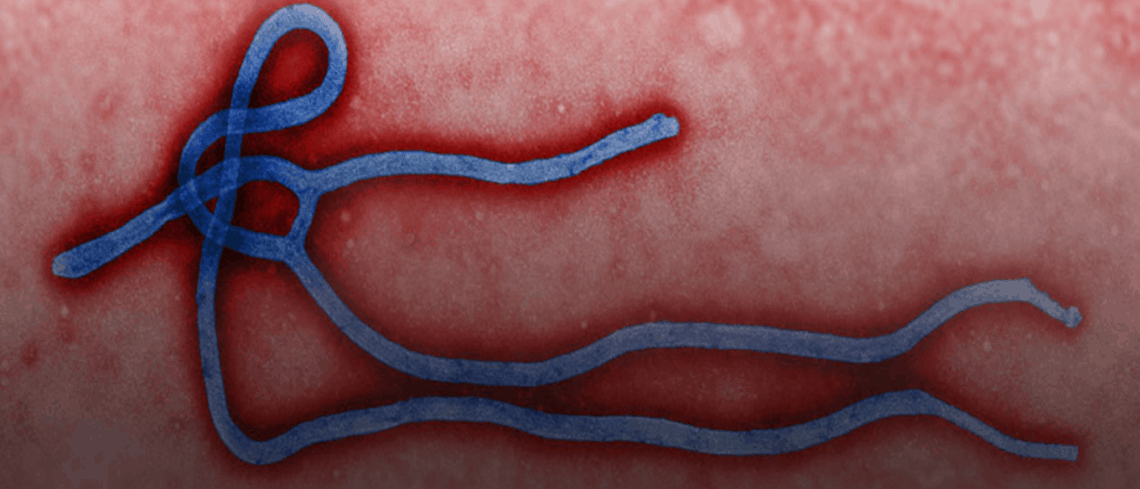 Ebola