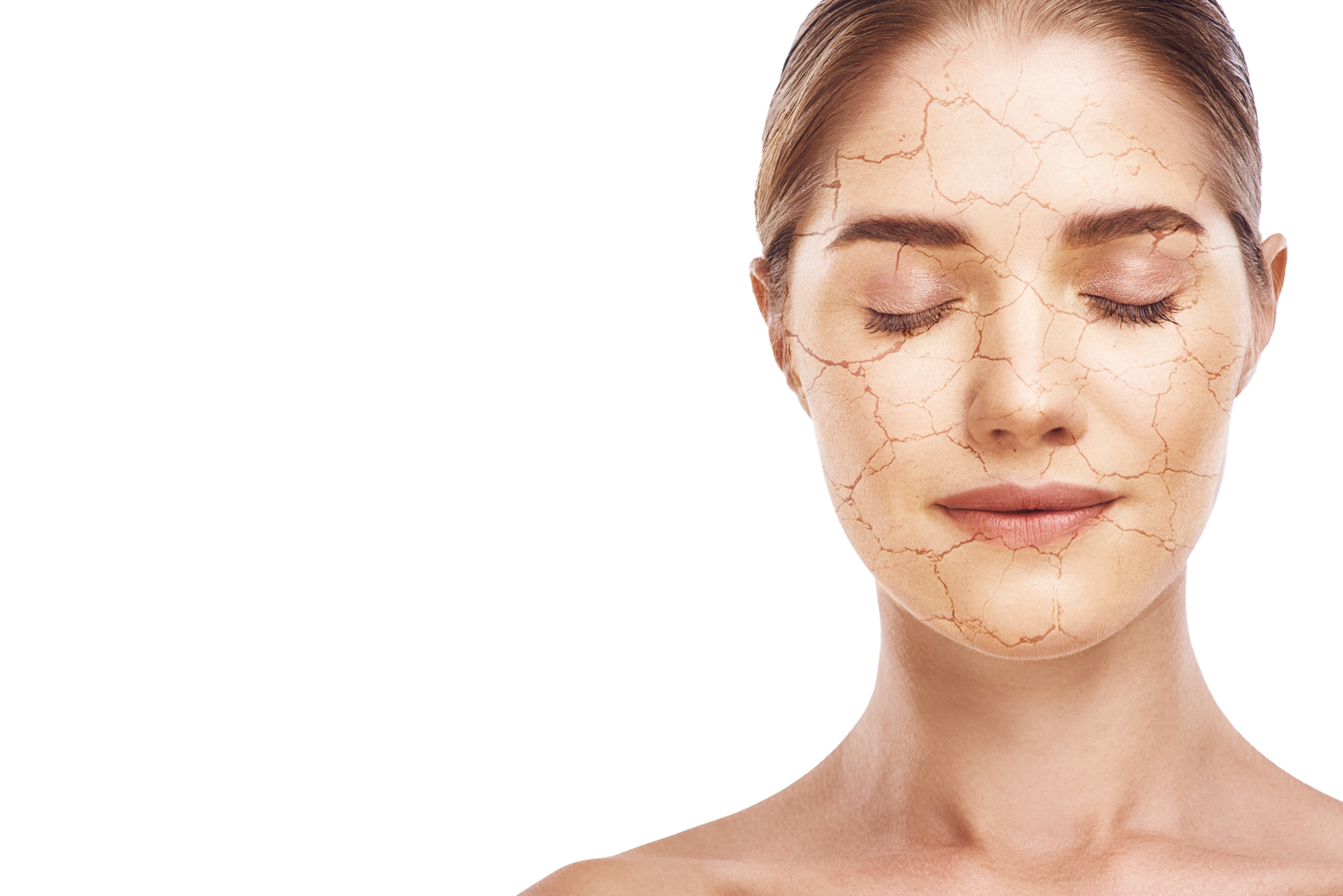 Woman with dry skin on face